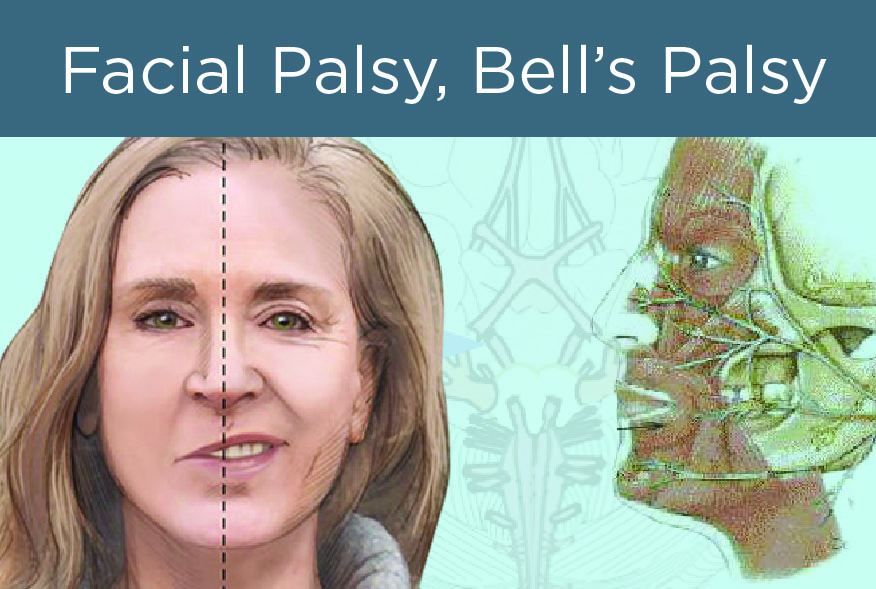 facial palsy, bell's palsy, rambut basuh masa tidur, bahaya tidur dengan rambut basah, keringkan rambut sebelum tidur