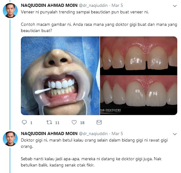 Sebelum Buat Rawatan Putihkan Gigi, Doktor Ini Kongsi Info ...